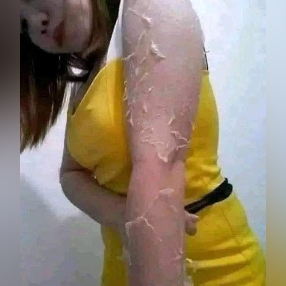 SkeenCare Peeling Lotion - Reveal Smooth, Radiant Skin! ✨ - Picture 6 of 7